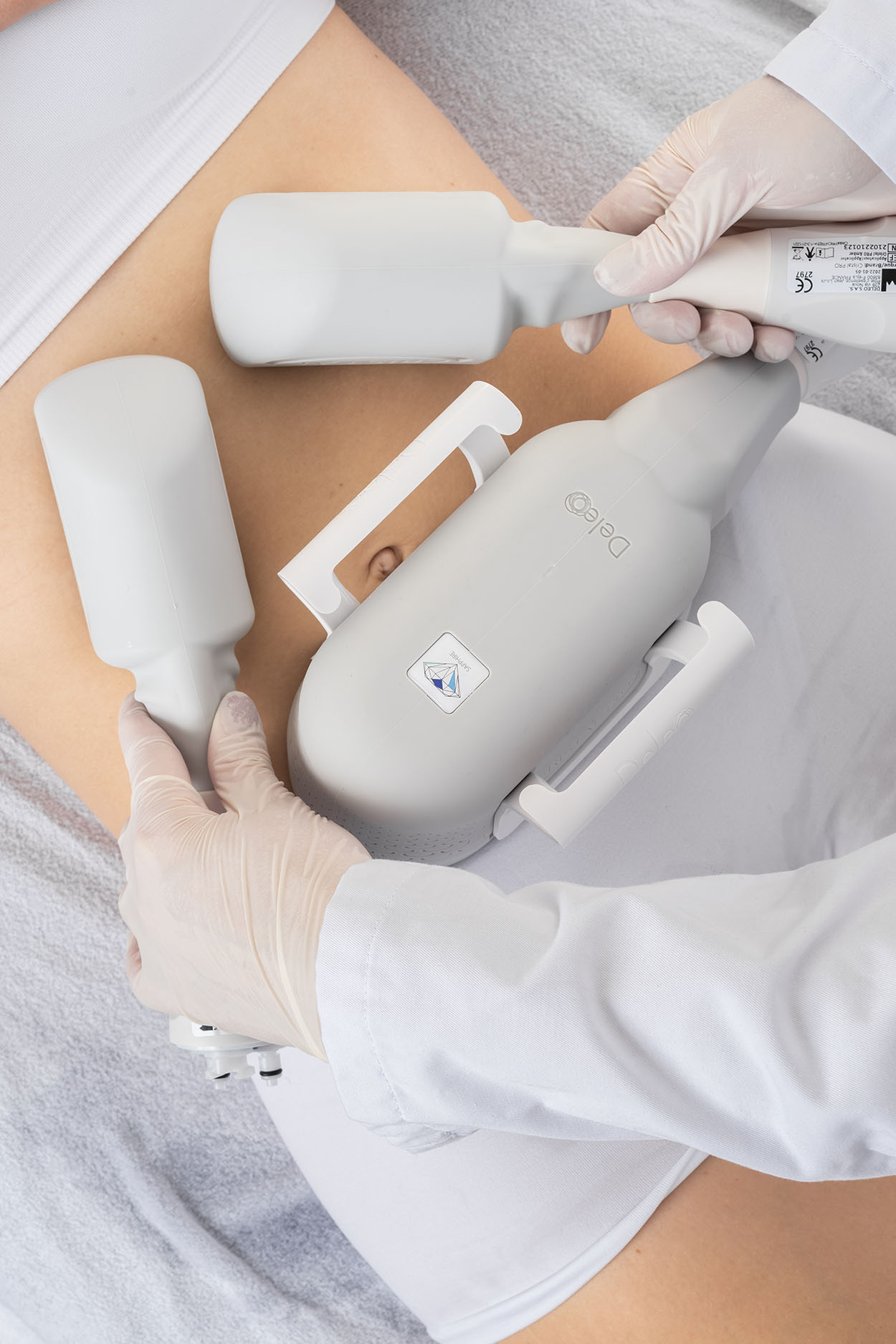 cryolipolyse bordeaux