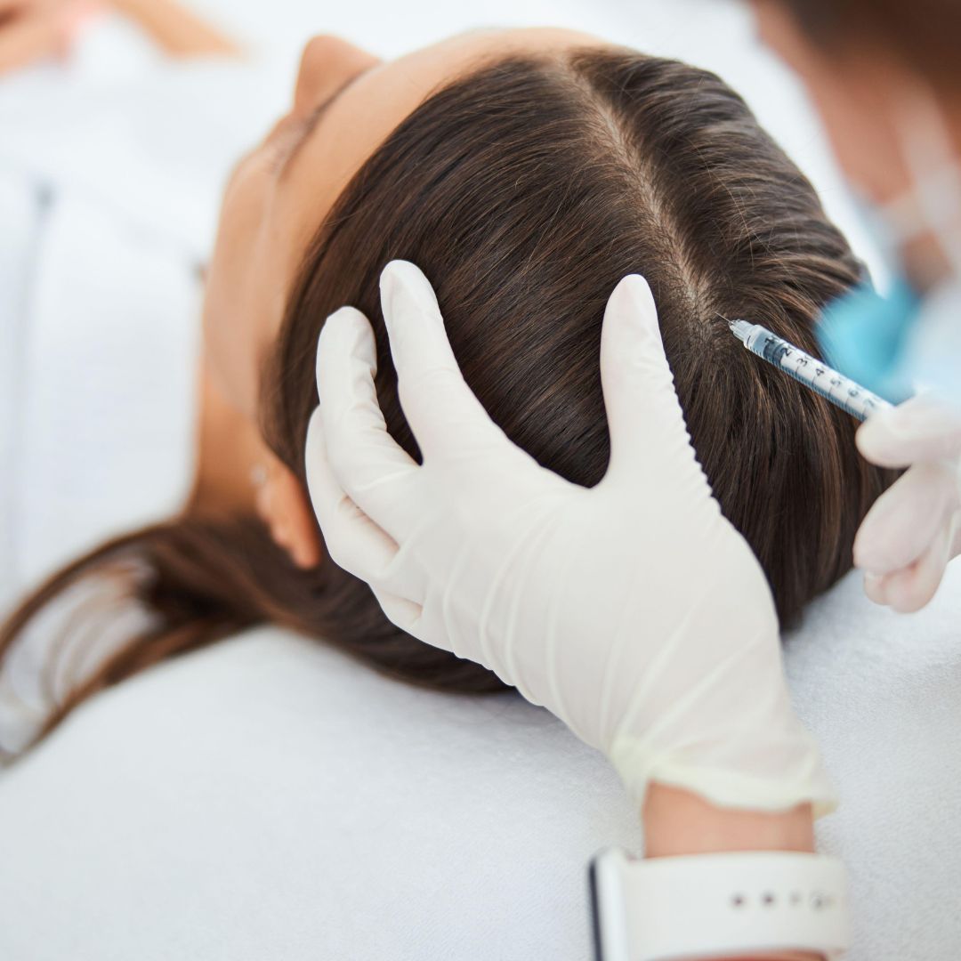 mesothérapie cheveux bordeaux