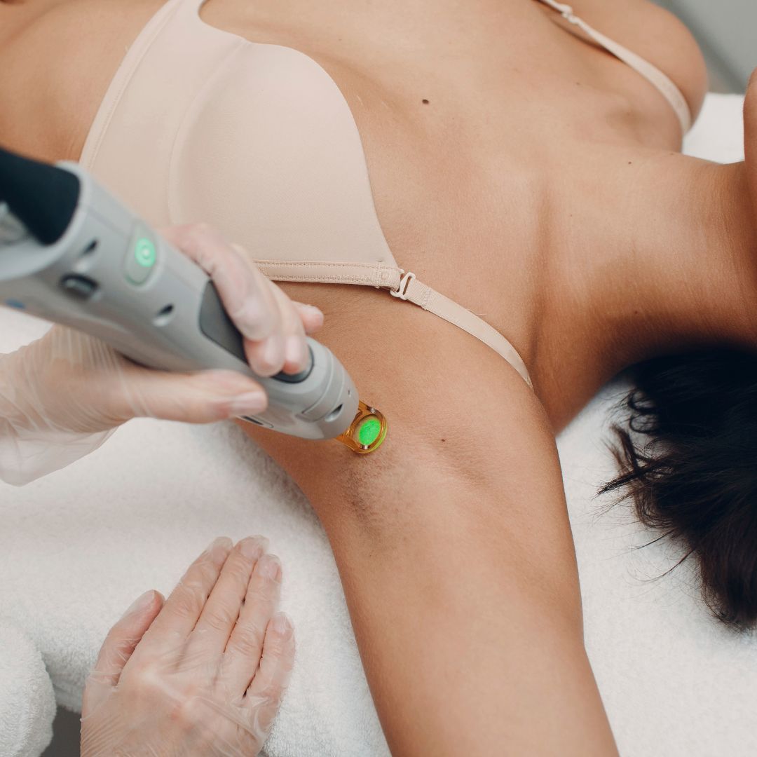 epilation laser bordeaux