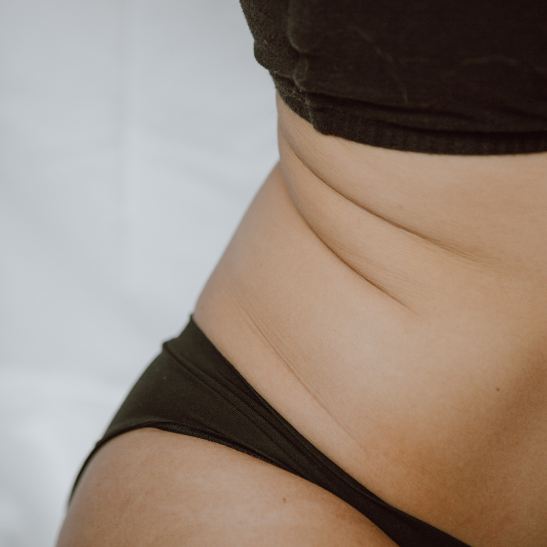 cryolipolyse bordeaux