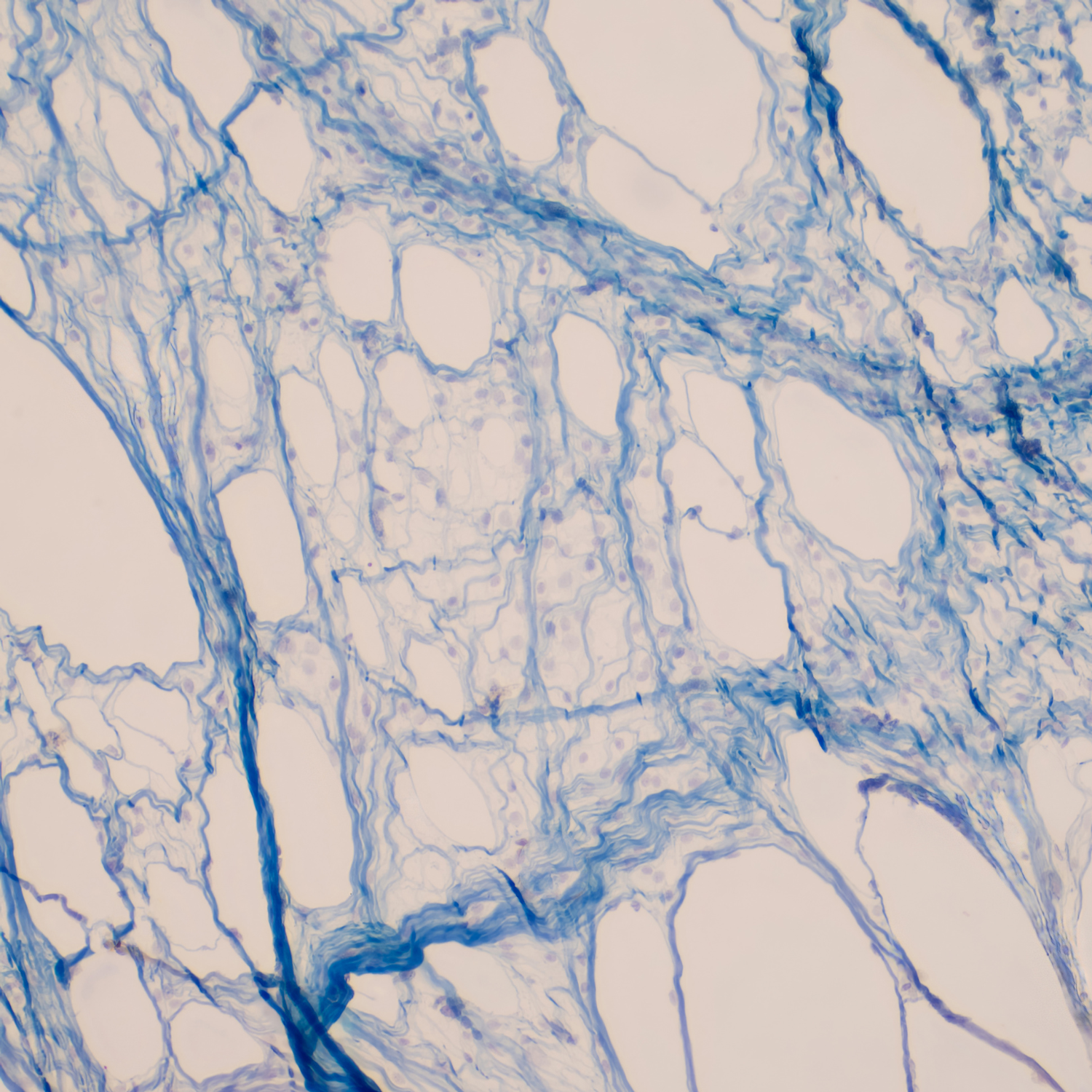 fibroblaste bordeaux