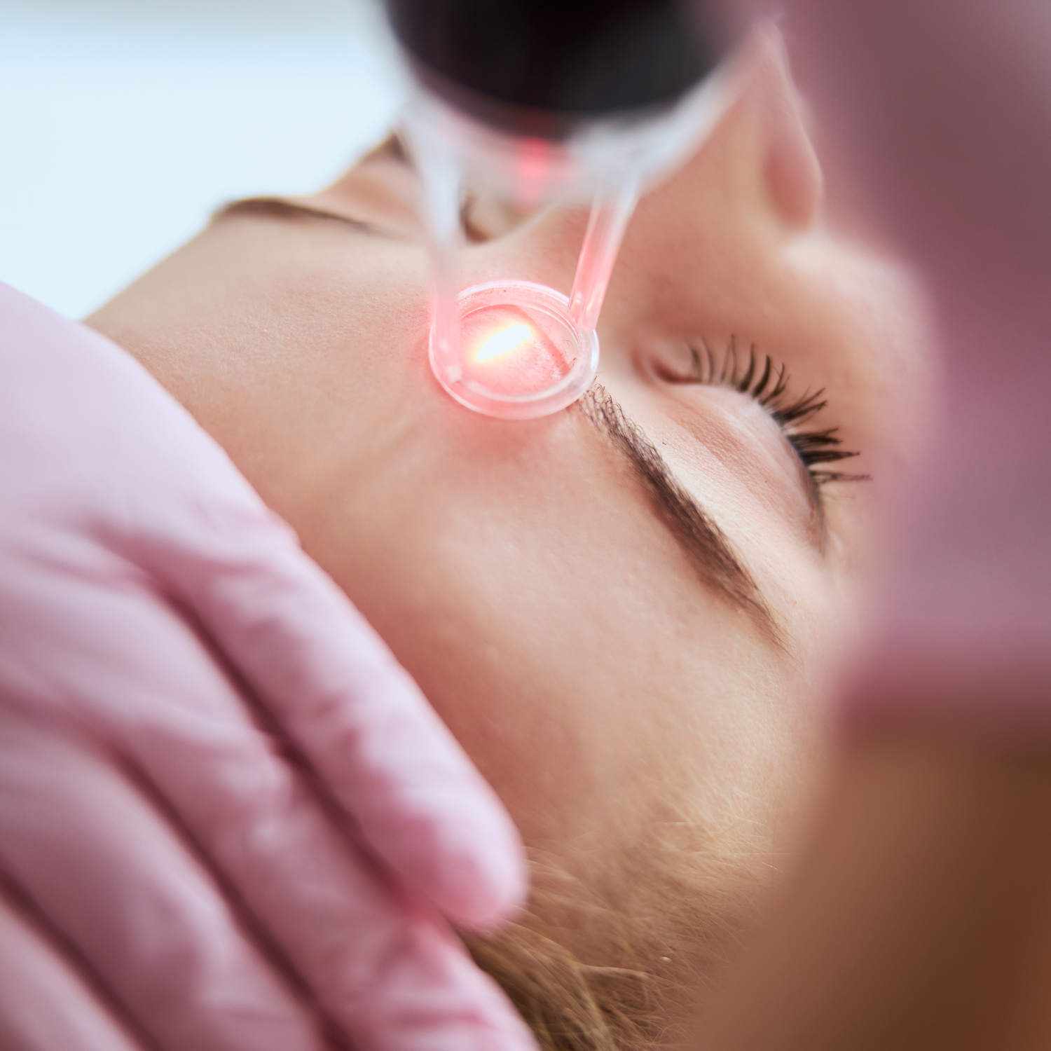 laser visage bordeaux