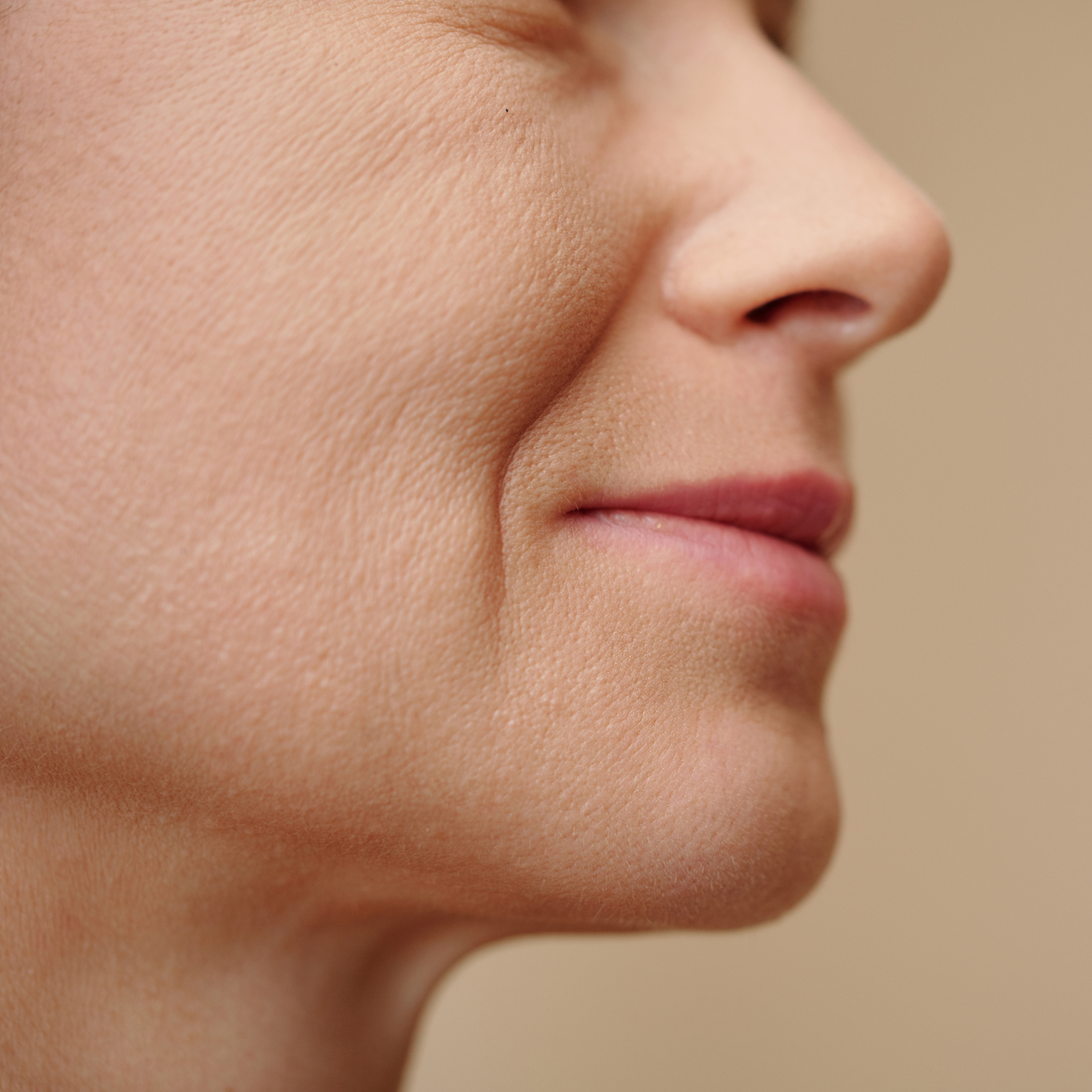 traitement rides bordeaux